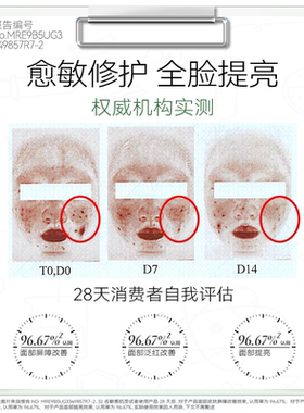 AOEO海葡萄面膜14天修红焕亮4盒