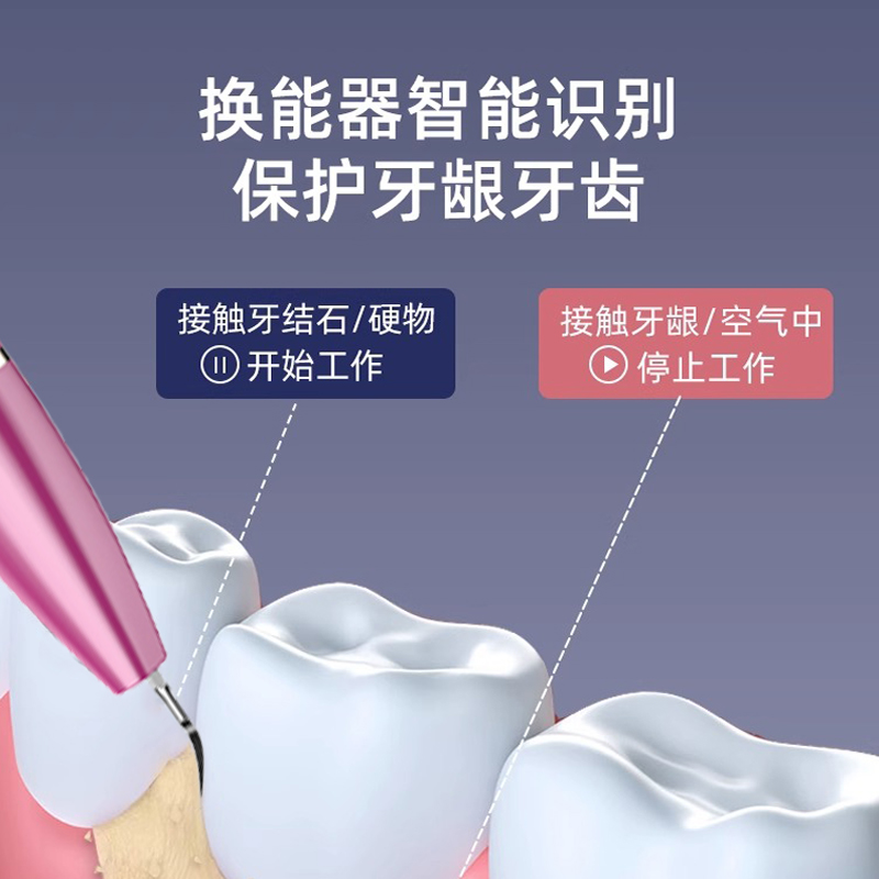 美国neward家用超声洁牙器洗牙去除牙结石牙垢烟渍神器声波冲牙器 - 图1