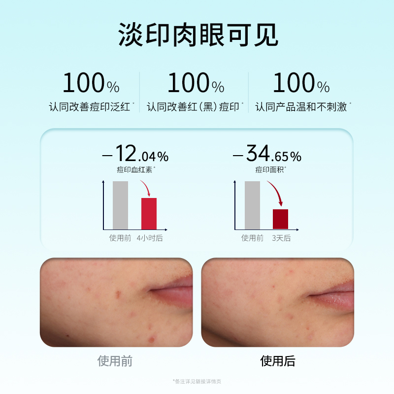 JOVS骄予时小纽扣电子祛痘贴痘痘贴LED光疗红光修护祛痘印抗菌