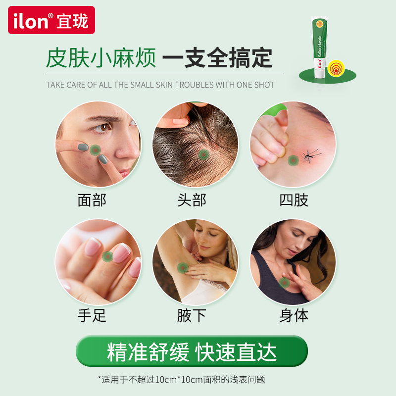 德国原装进口ilon头皮痘软膏局部长痘红肿痒痛毛囊炎25g/支
