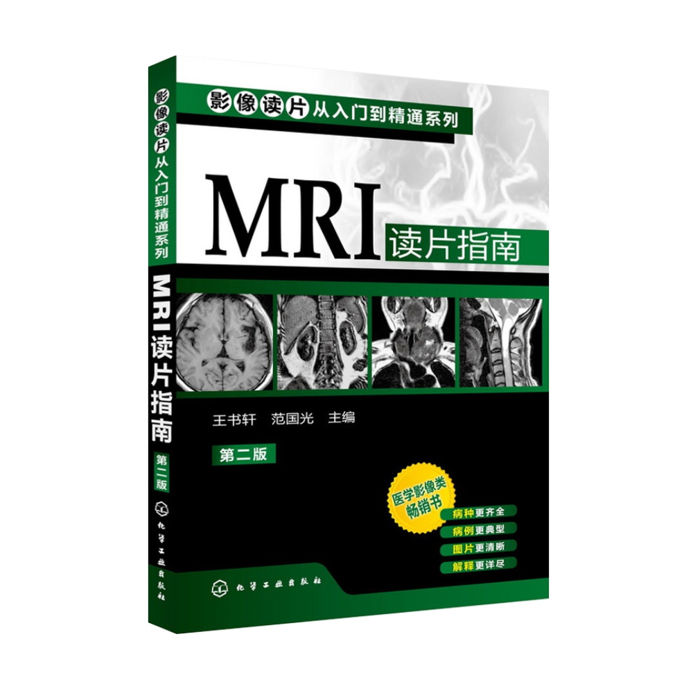 MRI读片指南第2版 影像读片从入门到精通系列 医学影像类新华书店 - 图0