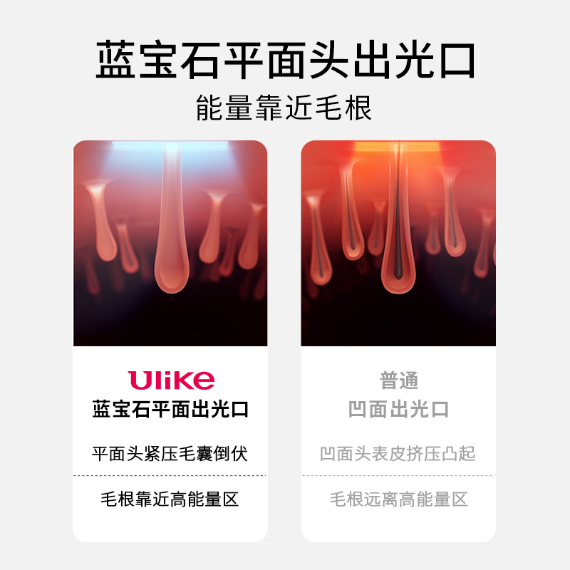 【蜜蜂欢乐社】Ulike蓝宝石冰点脱毛仪Air冰墨绿1件长效无痛脱毛 - 图1