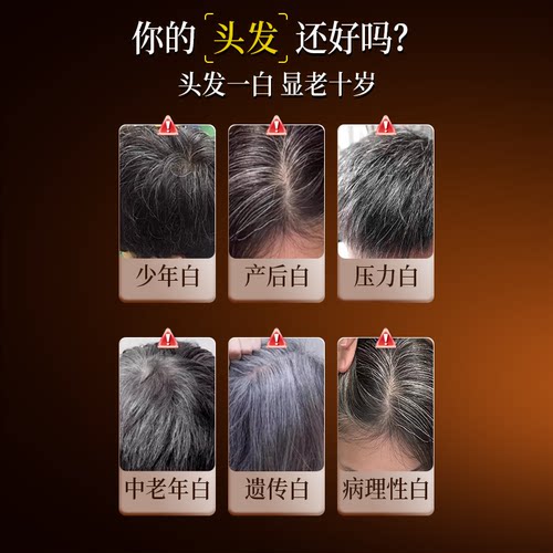 白云山拜迪生物锌硒维生素b6生物素片H白头发内调白转黑养黑正品 - 图1