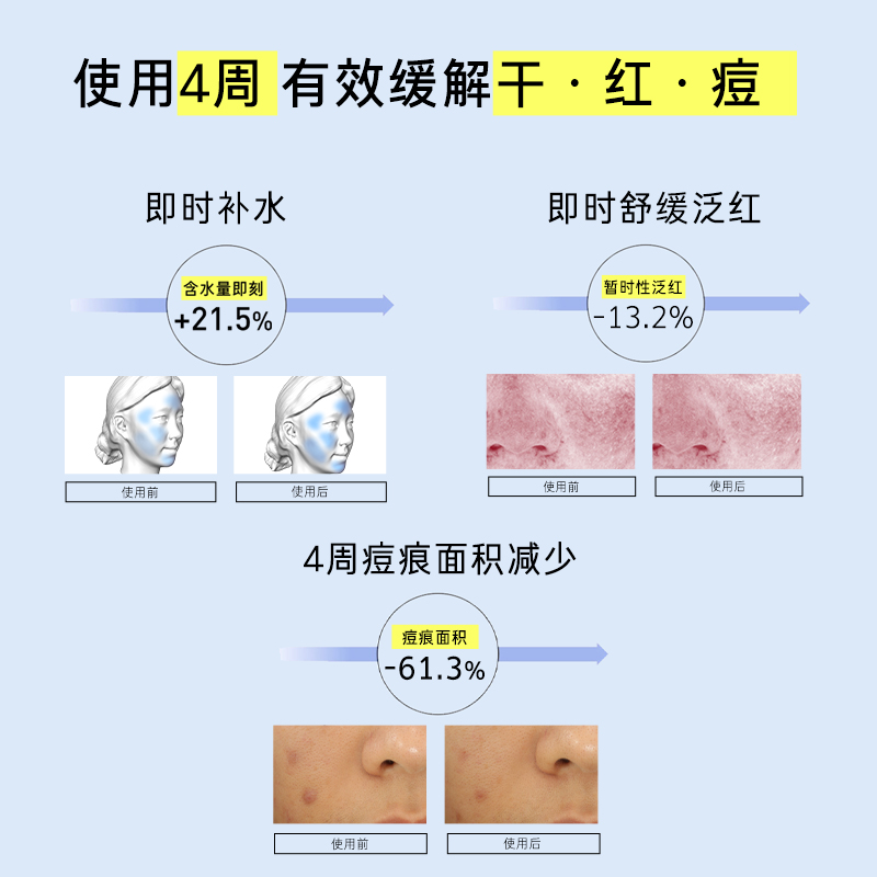 【618抢先购】梦妆蓝甘菊舒缓面霜面部保湿舒缓水润祛痘