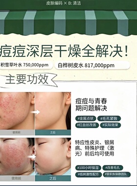 韩国本土敏肌痘肌快速舒缓镇静褪红修复抗菌抗炎高浓度水精华面霜