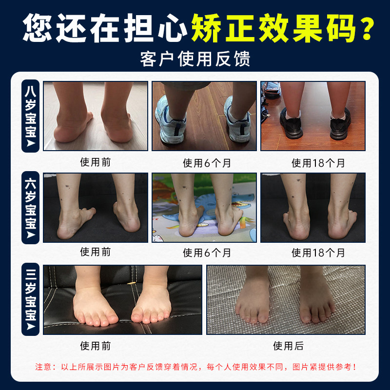 儿童机能矫正鞋扁平足外翻内外八字纠正垫学步足弓支撑凉鞋X型腿 - 图1