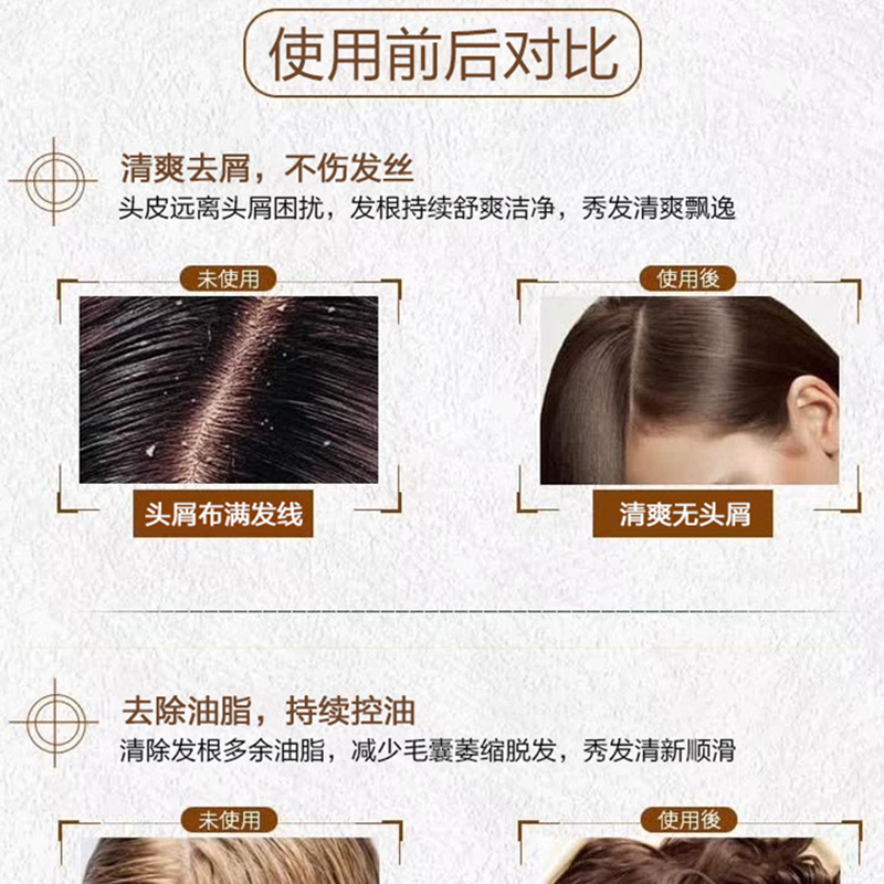 泰国进口ATREUS生姜洗发水正品防脱控油去屑止痒蓬松洗发露男士 - 图0