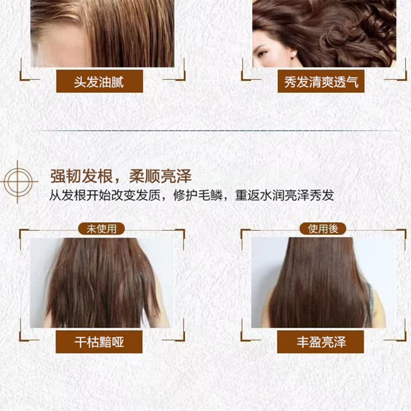 泰国进口ATREUS生姜洗发水正品防脱控油去屑止痒蓬松洗发露男士 - 图1