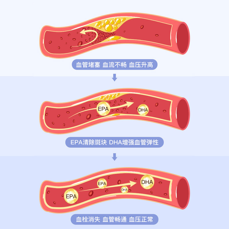 康健人生食品专营店买1发2鱼油软胶囊深海鱼油可搭配卵磷脂成人中老年辅助降血脂产品1