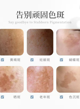 发光精华美白祛斑去黄褐斑晒斑