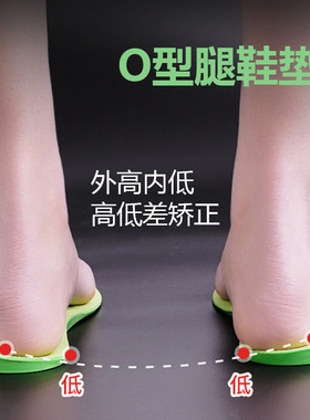 足内翻矫正器o型腿外八字脚鞋垫