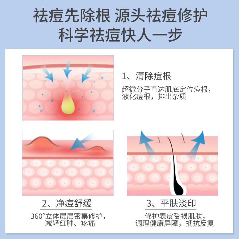 瓷肌正品祛痘膏 瓷肌乳液/面霜