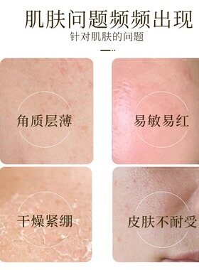 JohnJeff神经酰胺精华强韧屏障丰盈肌肤舒缓敏感保湿补水肌底液
