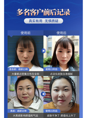 2025年新款玄极美容金水