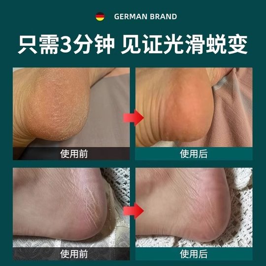 German pedicure and pedicure tool to remove dead skin and wash your feet