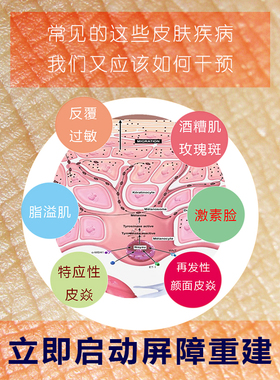 角质层过薄屏障受损敏感肌专用剂