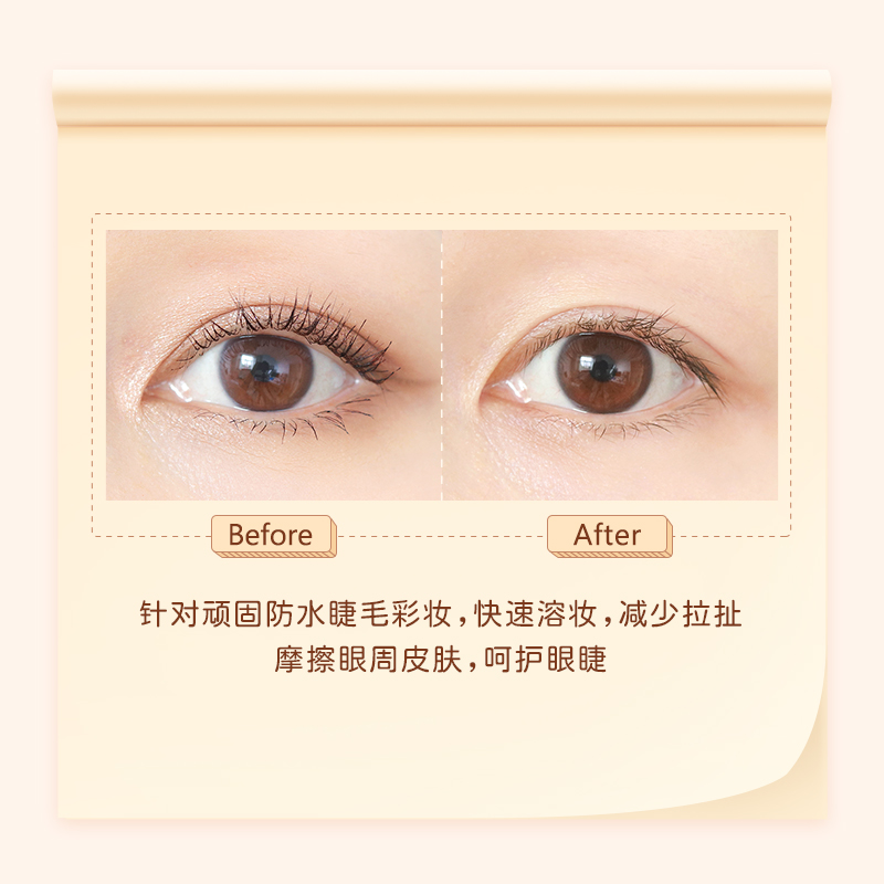 稚优泉化妆品旗舰店稚优泉睫毛膏卸除液专用温和不刺激卸护合一眼妆睫毛快速卸妆水液1