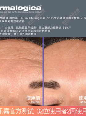 德美乐嘉e2泌萃精华液提拉焕新