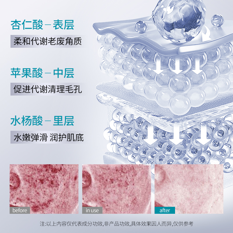 杏仁酸祛痘调肤冻膜控油保湿修护舒缓补水收缩毛孔面膜涂抹式男女