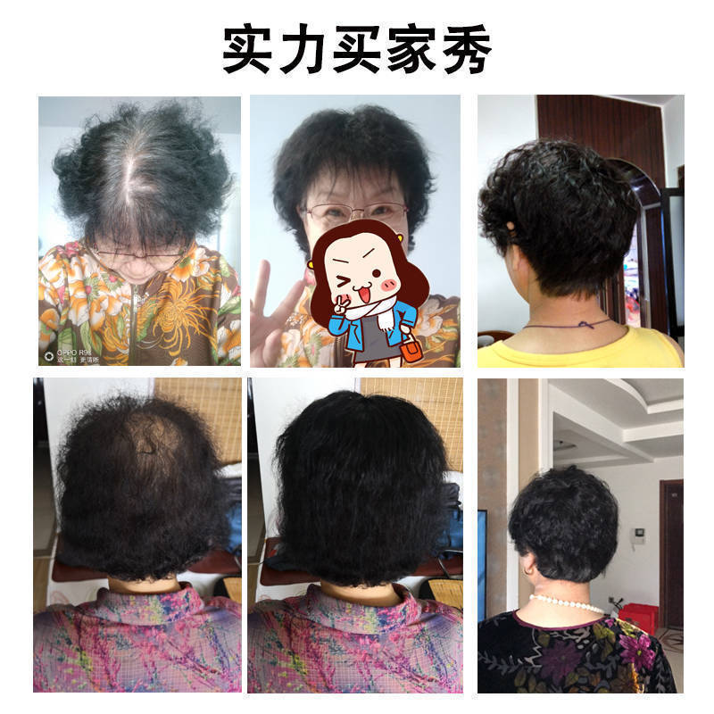 短卷发补发块发顶卷发假发片头顶遮白发蓬松真人发丝中老年送妈妈 - 图2