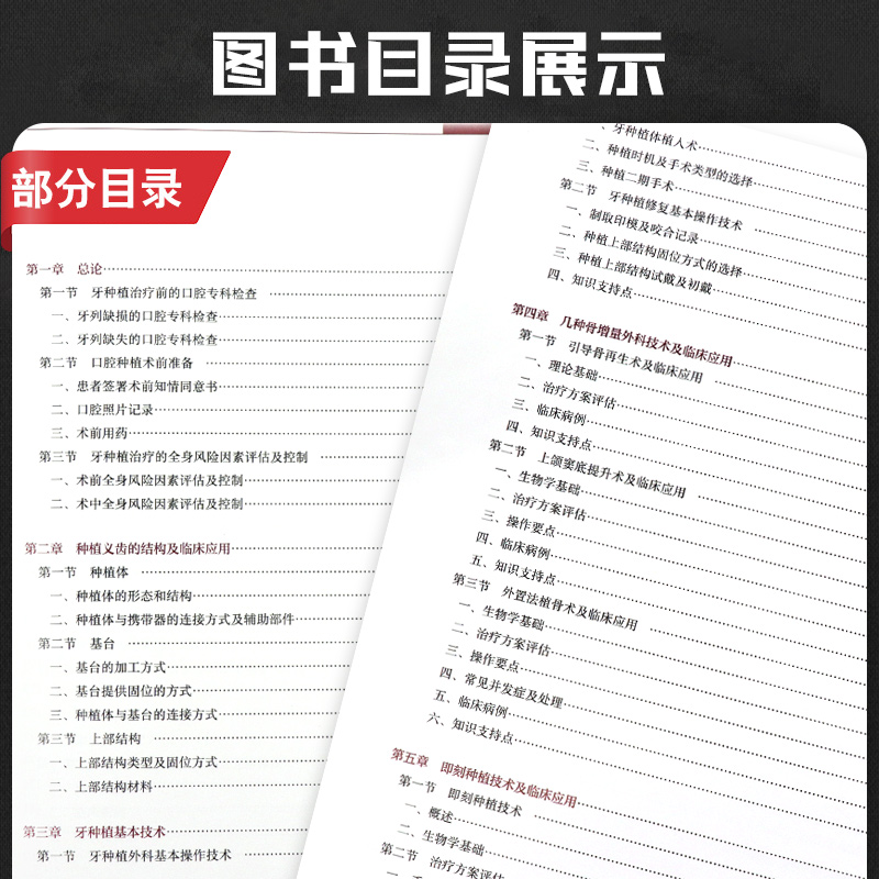 口腔种植临床操作与技巧 王佐林 主编 种植学倾斜书籍种植牙现代的精准植入技巧二期手术和取模大全美学区重建并发症全牙列修复书 - 图1