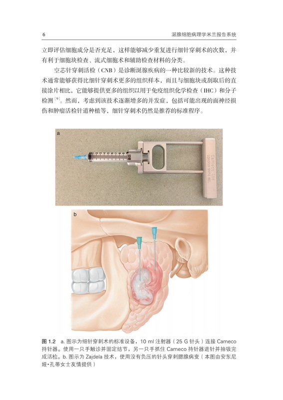 涎腺细胞病理学米兰报告系统 本书为细胞病理学米兰诊断系统的指南类图书 完整图像的注释说明 威廉法金 北京科学技术出版社 - 图0