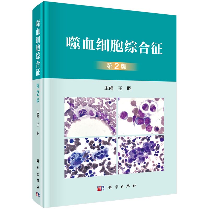 噬血细胞综合征 第2版 第二版 王昭 原发性噬血细胞肿瘤相关噬血细胞巨噬活化造血干细胞移植治疗技术免疫化学治疗分子靶向治疗