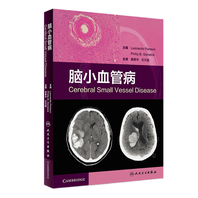 脑小血管病 脑小血管疾病是脑血管疾病的分支学科 临床脑小血管病的分类病理神经影像学治疗 脑血管造影预防心脑血管 心脑血管书籍