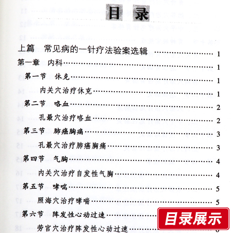 常见病的一针疗法单穴疗法验案荟萃针灸精华单穴疗法研讨会论文集及作者30多年来从事平衡针疗法的临床研究成果中国中医药出版社 - 图1