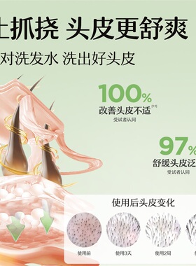 屈臣氏松达青少年控油系列便携装(洁面泡泡+洗发露+祛痘精华凝胶)