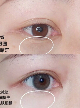 兰蔻超修小黑瓶发光眼霜