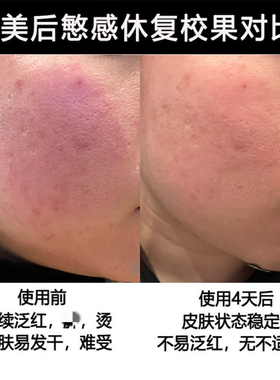 言之有物蓝铜胜肽面部精华液