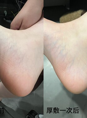 好用 南非Clere小绿膏草本乳霜手足干防裂膏冬季脚裂脚后跟干裂