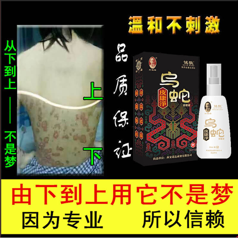 诚敬乌蛇皮康净喷剂断痒拔毒膏正品止痒皮痒老牛皮手脚头体止痒膏_虎窝淘