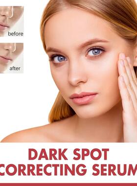 跨境Hoygi SpotsPigmentationAge EDP Yokoh吉 Niacinamide Serum