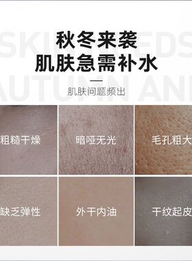 依妍男士保湿乳液滋润护肤保湿滋润水嫩秋冬四季160ml