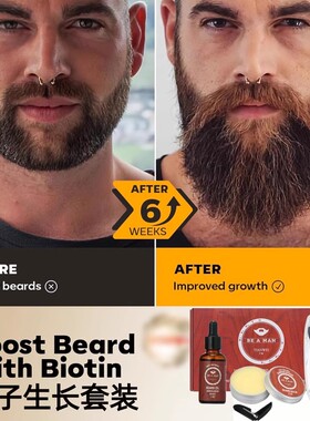 BeardGrowthKit男胡须生长滚轮