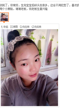 韩版蕾丝发箍长刘海魔法贴