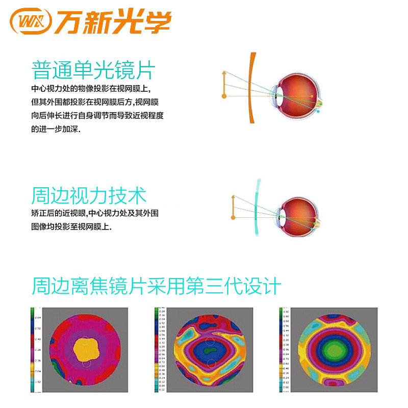 万新乐轻松镜片周边离焦近视眼镜易百分孔雀版防蓝光学生眼镜2片 - 图3