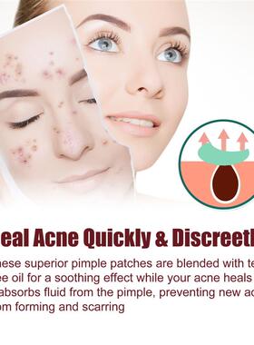 Acne patch series for repairing cleaning痘痘贴系列修护清洁闭