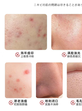 德皙妮痘精华淡化痘印官方正品旗舰店德皙妮草本痘精华水改善油痘