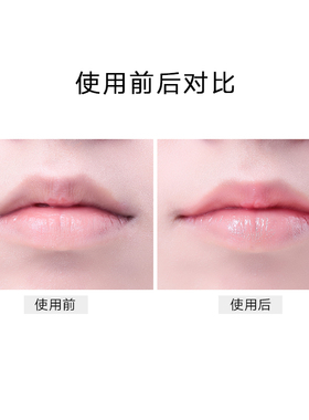日本委托代买资生堂Moilip润唇膏保湿滋润修复口角唇部护理8g男女