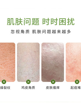 花水匠艾草精油沐浴露除螨滋润