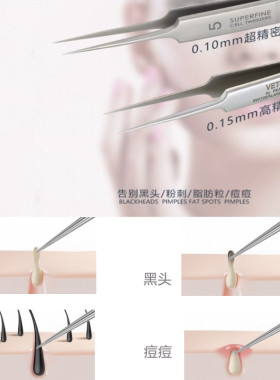 VETUS不锈钢高精密超细尖镊子