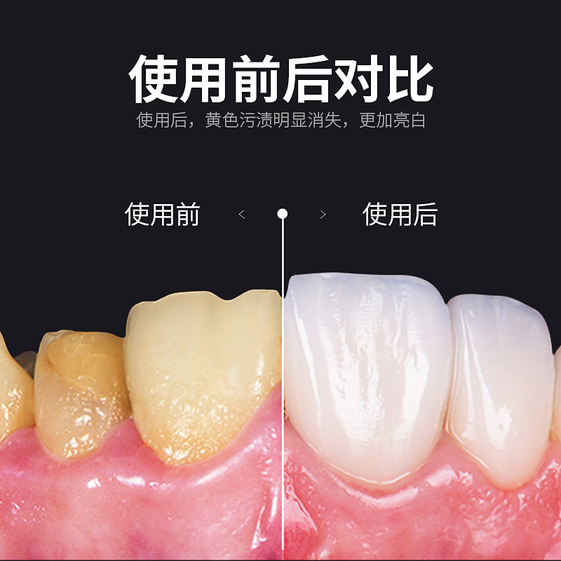 壹念旗舰店洗牙粉洁牙粉非牙齿美白神器去黄牙烟牙渍口臭牙斑净男女小苏打3