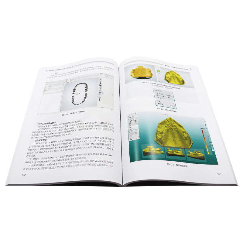 口腔数字化技术 第2版 王勇 高等职业教育创新教材 供口腔医学技术专业用 口腔技工室实际工作内容 人民卫生出版社9787117348386