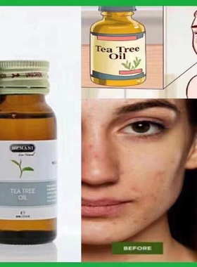 巴基斯坦茶树精油HEMANI祛痘