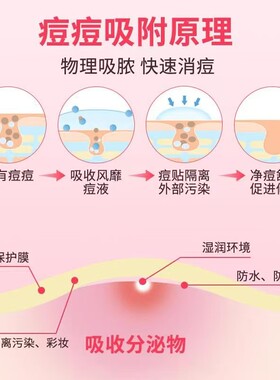可爱星星水体轻薄透气遮痘贴