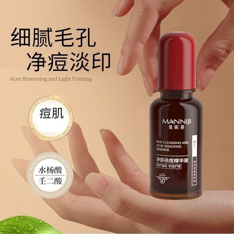 祛痘精华液水杨酸祛痘水去闭口粉刺痤疮修红淡化痘印平衡水油原液,淘宝优惠券,粉丝福利购,淘宝优惠卷