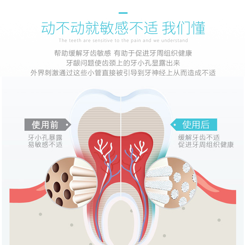 岂止美Sensiv敏感牙膏缓解牙齿冷热酸甜牙膏100G正品包邮医院有售